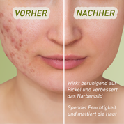 Trinitae ausgleichender Toner mit pflanzlichen Extrakten & Hyaluron